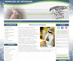 remocaodetatuagem.com.br: Remoção de Tatuagem em São Paulo
clinica de remoção de tatuagem em São Paulo com laser Yag, tratamento para retirar tatuagem em São Paulo, eliminar tatuagens em Porto Alegre - RS e São Paulo - SP, remoção de tatuagem a laser, remoção de tatuagem com tratamento a laser.