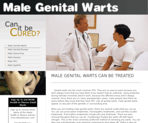 malegenitalwartstreatment.org: Male Genital Warts
Genital warts are the most common STD. They are so easy to pass because you don't always know that you have them if you haven't had an outbreak.