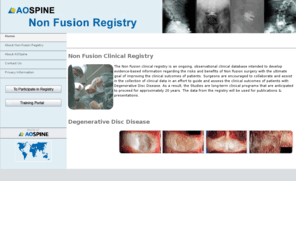 nonfusionregistry.com: AOSpine Non-Fusion Registry :: Home page
