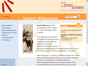 hellerhautkrebs.info: Aktion Lichtblick e.V. - Homepage
Mit www.aktionlichtblick.de wendet sich die Aktion Lichtblick - eine Initiative gegen Hellen Hautkrebs an Betroffene, Angehörige und potentielle Patienten, um über bestimmte Formen des Hellen Hautkrebs zu informieren und auf die sanfte Behandlungsart der 