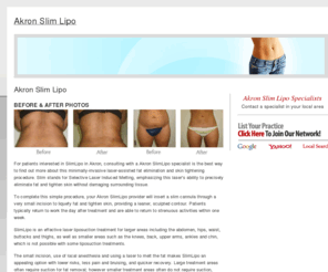 akronslimlipo.com: Akron Slim Lipo
Find an Akron Slim Lipo specialist in your area. Learn about this laser liposuction procedure, view before and after photos of patients, learn about the cost, benefits and results of Slim Lipo.
