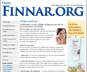 finnar.org: Finnar Bli av med finnar
Har du problem med finnar. Få tips på behandlingar av finnig hy...