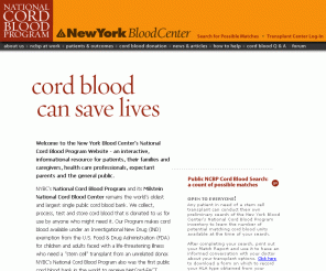 nationalcordbloodprogram.org: National Cord Blood Program
Provides information about cord blood, donation, patients and transplants. Through the Transplant Center Log-In feature, Physicians and Transplant Coordinators can conduct 'formal' searches for HLA matched units for their patients. A public cord blood search feature allows anyone an on-line opportunity to get 'informal' preliminary count of potentially matching units in the NCBP inventory.