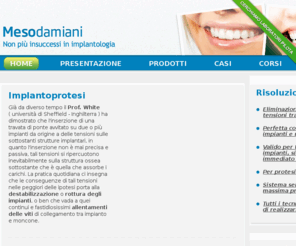 implantologia-damiani.it: Implantologia dentale: soluzione alla passivazione su impianti dentali | MESODAMIANI
Implantologia dentale e Implantoprotesi: La DA.MA. srl produce  un sistema per realizzare una mesostruttura dentale che permette una perfetta connessione tra impianti e monconi garantendo la totale eliminazione delle tensioni tra impianti.