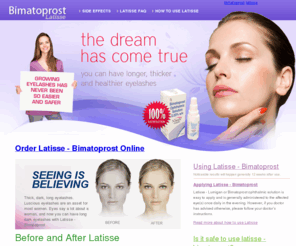 buybimatoprost.net: Buy Bimatoprost, Latisse, X-Lash Safely Online
Buy Generic Xlash For Long, Thick Eyelashes!