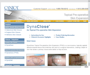 dynaclose.com: Canica Design - Developing and Selling Wound Closure Systems and Surgical Instruments
Canica offers a range of innovative medical products including safety scalpels and wound closure devices for surgical and clinical use.