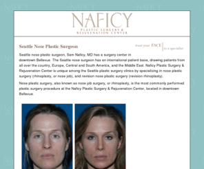 seattlenoseplasticsurgeon.com: Nose Plastic Surgeon in Seattle - Rhinoplasty at Naficy Plastic Surgery & Rejuvention Center
Seattle Nose Plastic Surgeon - Sam Naficy, MD