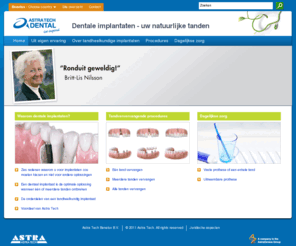 zoalsnatuurlijketanden.nl: Astra Tech - Dentale implantaten von Astra Tech
Indien u kiest voor tandheelkundige implantaten van Astra Tech, bent u verzekerd van voorspelbare, betrouwbare en langdurige resultaten.