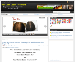 preventthinninghair.com: Prevent Thinning Hair With The Scientia Laser Brush Stops Hair Loss & Promotes Hair Regrowth
The Revolutionary Scientia Hair loss laser treatment for home to prevent thinning hair and stops hair loss and promotes healthy hair regrowth