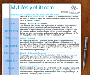 mylifestylelift.com: Lifestyle Lift Pictures| Reviews| Comments| Journal - My Lifestyle Lift
My Lifestyle Lift is a journal by Maureen which features, before and after pictures from Lifestyle Lift procedure, reviews and comments on Lifestyle Lift.  