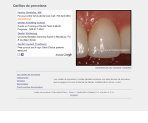 carillasdeporcelana.com: Carillas de porcelana
Información sobre carillas de porcelana.