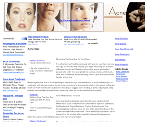 acneskinscars.com: Acne Skin Scars - Acne Scar
Acne Scar explained: an acne skin care article to help you deal with acne.