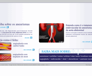 tratamento-varizes.com: Aneurisma da aorta abdominal, artérias carótidas, varizes...Cirurgia vascular e endovascular
Informação e prevenção sobre o aneurisma da aorta abdominal, varizes, obstruções das carótidas e tromboses entre outras doenças vasculares.  