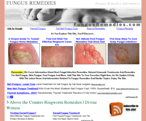 fungusremedies.com: Fungus Remedies
Fungus is a common problem many of us must deal with daily.  We have put together one of the Internet's biggest collections of information about fungus remedies.  We cover everything from toenail fungus remedies, fingernail fungus remedies, to foot fungus remedies, and scalp fungus remedies.