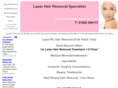 advancedlaser.co.uk
