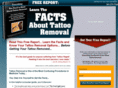 thetruthabouttattooremoval.com